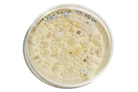 Microbes and Microorganisms Testing Laboratories